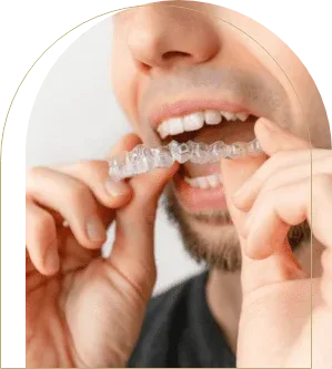 Natural-looking porcelain veneers Mosman for smile makeover