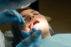 Is Teeth Whitening Permanent procedure How to Improve Oral Hygiene check