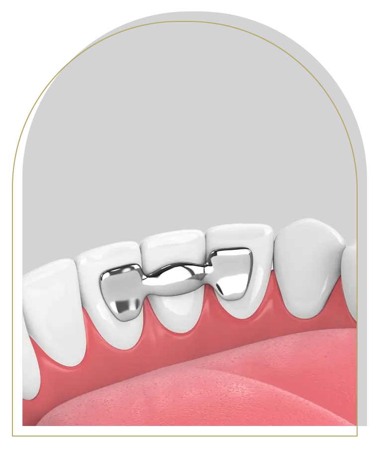 Maryland Bonded Bridges