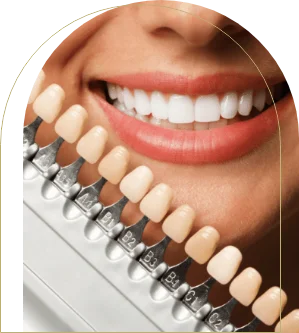 Cosmetic dentist selecting veneer colour for smile makeover – what are porcelain veneers