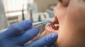 Can Dental Implants Get Cavities? What Can Go Wrong and How to Avoid It