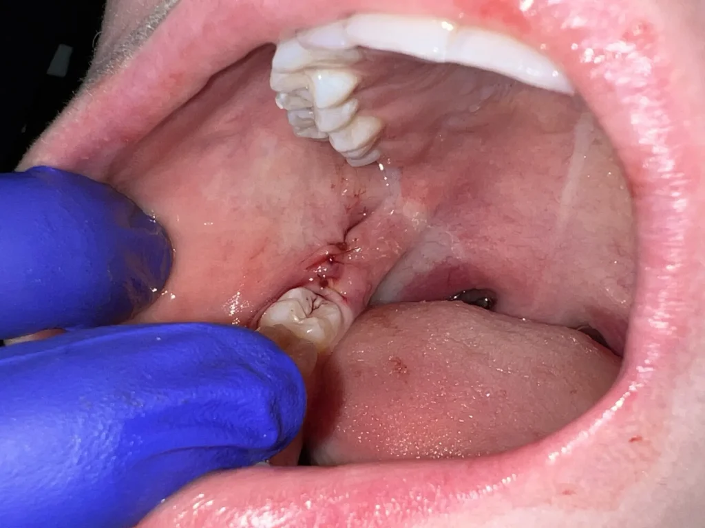 The Advanced Dental Care Mosman Approach