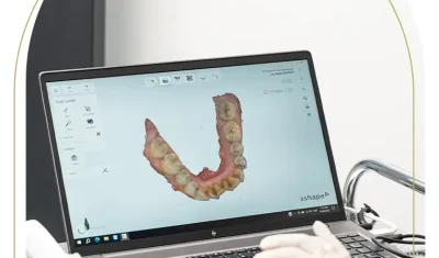 Professional dental consultation for restorative dentures at Advanced Dental Care Mosman Dentist clinic in Mosman.
