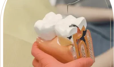 Dental Implants Advanced Dental Care Mosman.webp