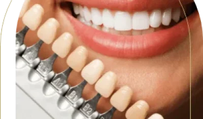 Cosmetic dentist selecting veneer colour for smile makeover – what are porcelain veneers